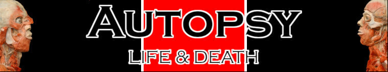 Autopsy: Life and Death